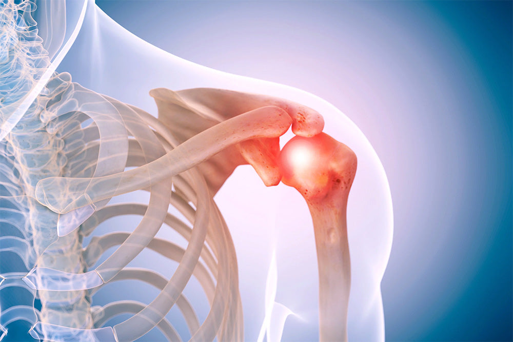 Standing Desks Can Help With Anterior Shoulder Pain: Here's How